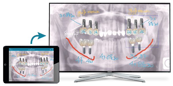 dentalpad ipad tele