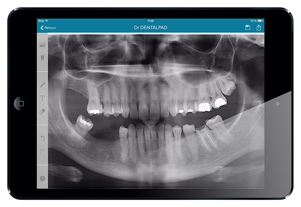 dentalpad ipad radio